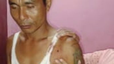 Polsek Pulau Rupat Diminta Segera Tangkap Pelaku Pengeroyokan